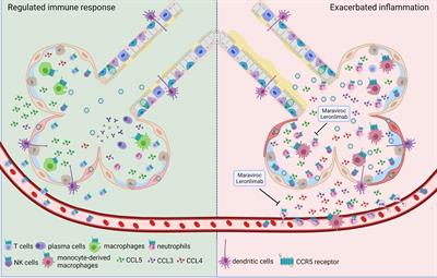 The Dual Role of CCR5 in the Course of Influenza Infection: Exploring Treatment Opportunities